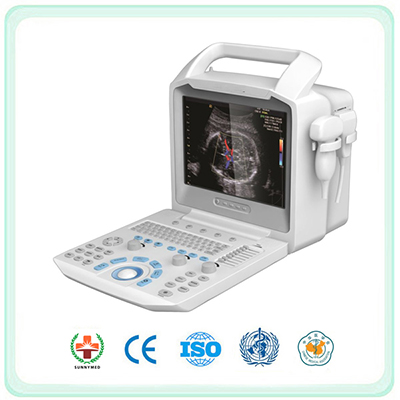 SV3 Portable All Digital Color Doppler Ultrasound Scanner